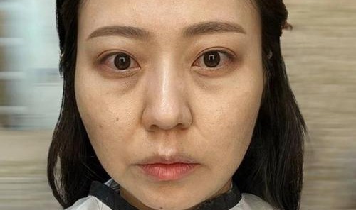 姐姐们眼周都还没有皱纹,你却先有了?