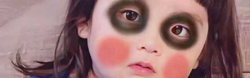 有黑眼圈的我，是真的累