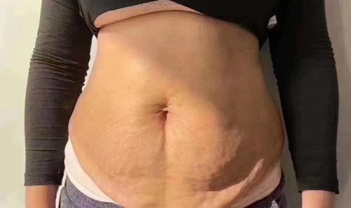 生娃之后肌肤松弛显老？看了她们之后觉得并没有啊！