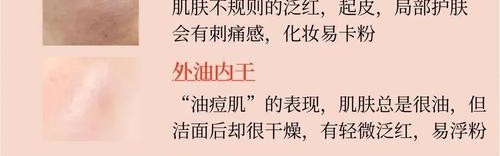 一不小心就烂脸,你确定要跟风给肌肤下猛药?