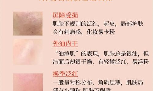 一不小心就烂脸,你确定要跟风给肌肤下猛药?