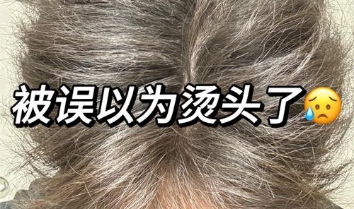 废柴头发这样养护还能救？