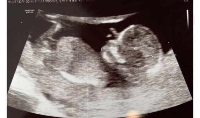 他们竟吃上了男团偶像这碗饭！