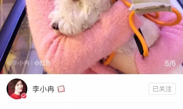 戚薇李小冉牙齿比皮肤还白的秘诀,听说在家就可以get?