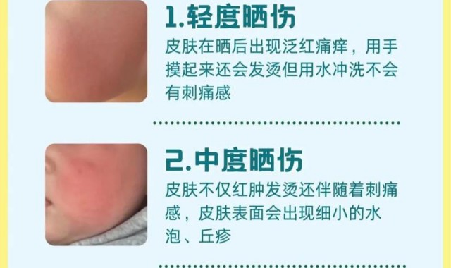 炎炎夏日脸部身体急需“灭火”,这些清爽单品都是你的菜!