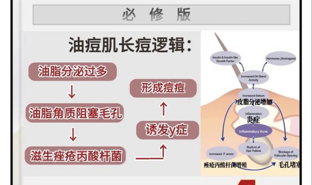 安抚油痘肌&干敏皮,肌肤也要断舍离!