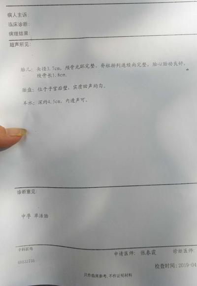 命里无子八字-从八字看什么人会命中无子