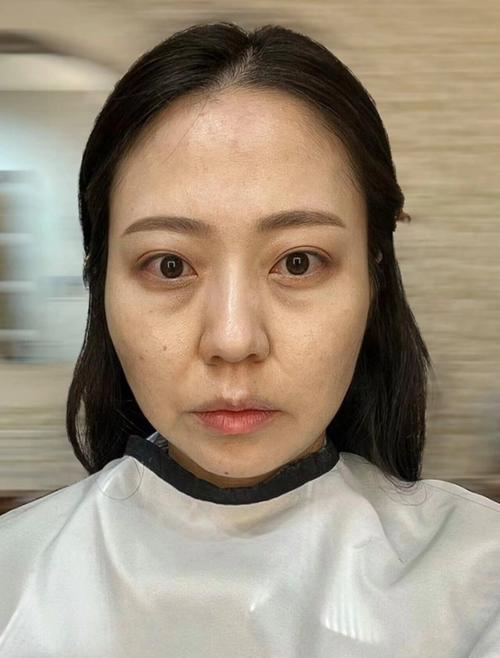 姐姐们眼周都还没有皱纹,你却先有了?