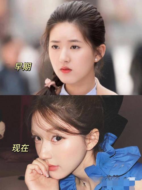 赵露思同款可爱苹果肌,真不是吃苹果吃出来的,请点击这里查看!