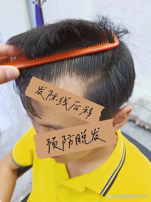 2021许个愿:我要不会掉的发际线!