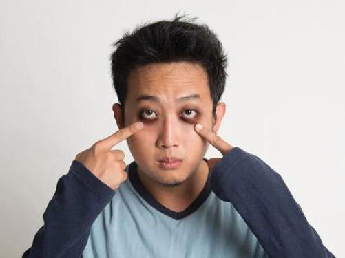 有黑眼圈的我，是真的累