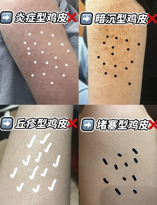 真皮包皱了怎么恢复,老母鸡油不能用热水洗最多用湿布擦一下