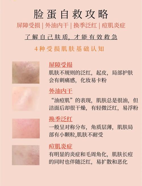 一不小心就烂脸,你确定要跟风给肌肤下猛药?